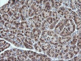UBE2G2 Antibody (clone OTI1D7)