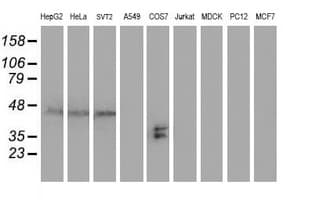 SH2D2A Antibody (clone OTI3C7)