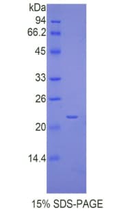 Human CRYAA / Alpha A Crystallin Protein (Recombinant His, N-Terminal)