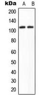 CCAR2 / KIAA1967 Antibody (Internal)