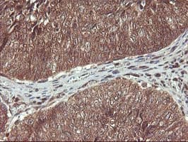 HDHD1 Antibody (clone OTI7A2)