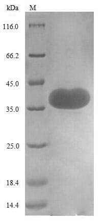 Human CD44 Protein (Recombinant 6His-SUMO, N-terminus)