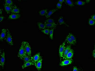 IHC-plus™ BLOC1S1 Antibody