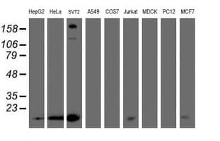 Monoclonal Mouse anti-Human PMVK Antibody (clone OTI2D1, WB)