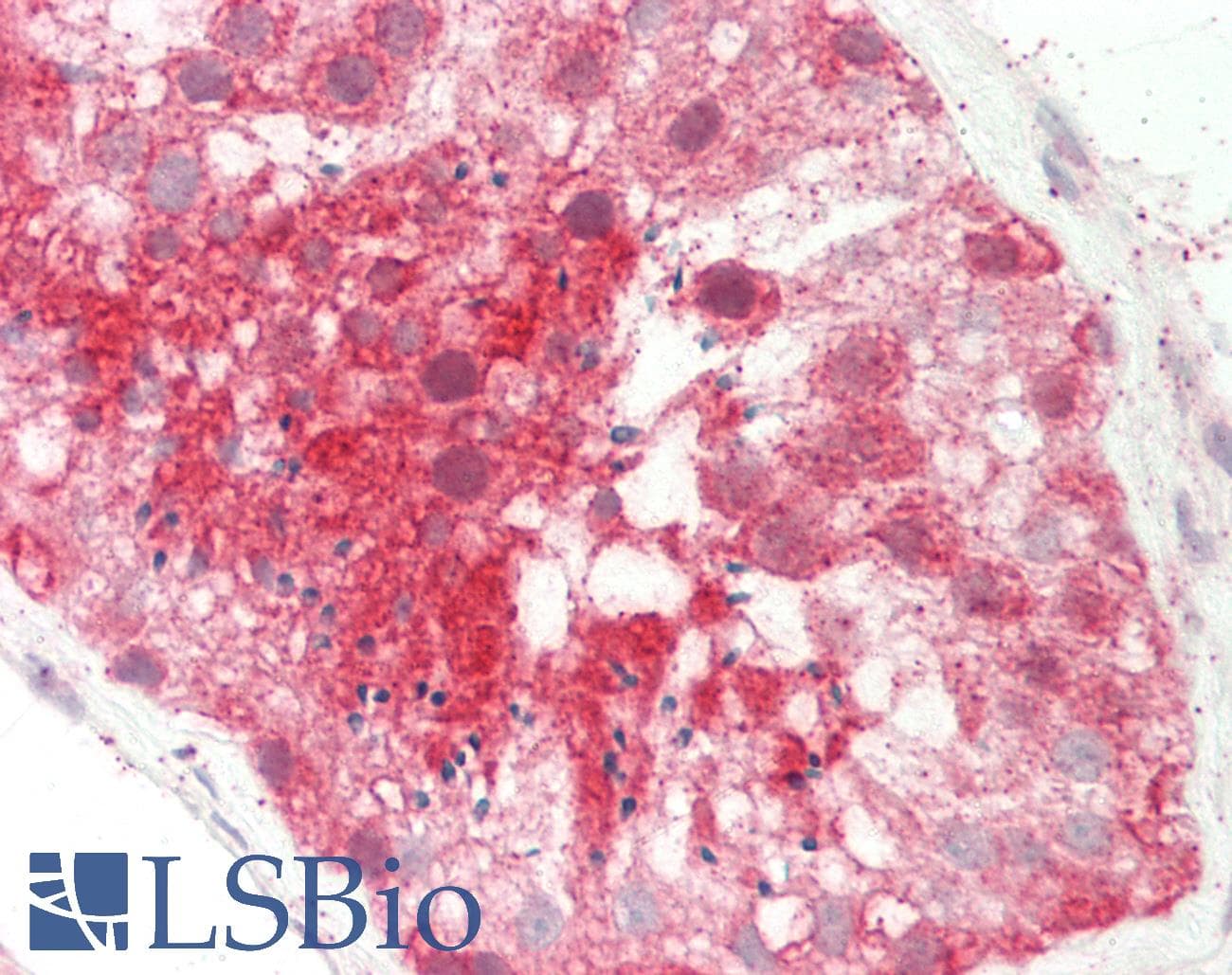 Polyclonal Rabbit anti-Human CCT5 / TCP1 Epsilon Antibody (C-Terminus, IHC, WB)