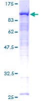 Human RDX / Radixin Protein (Recombinant GST)