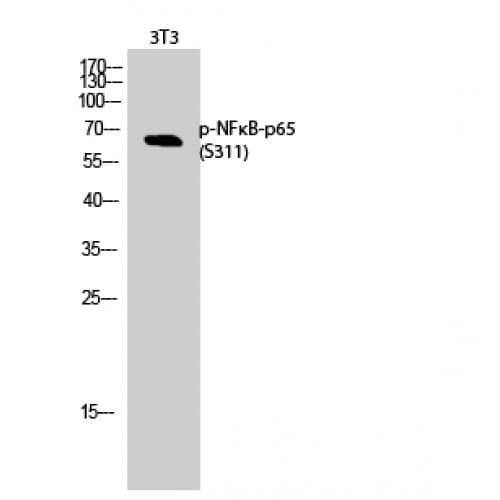 Polyclonal Rabbit anti-Human RELA / NFKB p65 Antibody (250-330 aa, IHC, IF, WB)