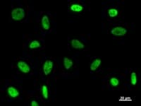 Monoclonal Mouse anti-Human GTF3C2 Antibody (clone 2395C2a, IF, WB)