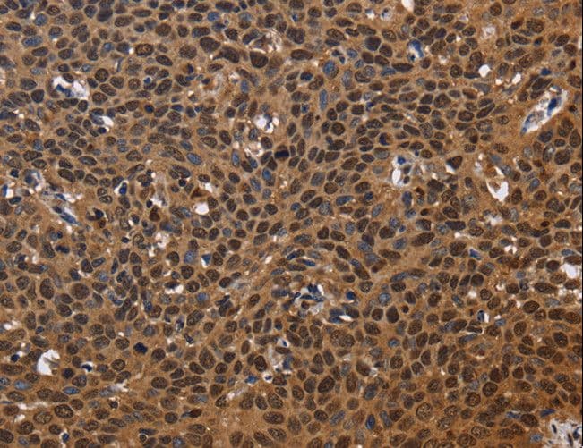 EXTL3 Antibody