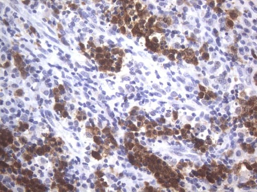 Monoclonal Mouse anti-Human POU2AF1 / BOB1 Antibody (clone UMAB219, IHC)