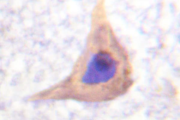 Polyclonal Rabbit anti-Human FAK / Focal Adhesion Kinase Antibody (Pro906, IHC)
