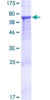 Human MYO1D Protein (Recombinant GST)