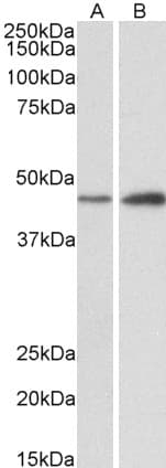 IHC-plus™ Polyclonal Goat anti-Human NDRG2 Antibody (aa25-39, IHC, WB)
