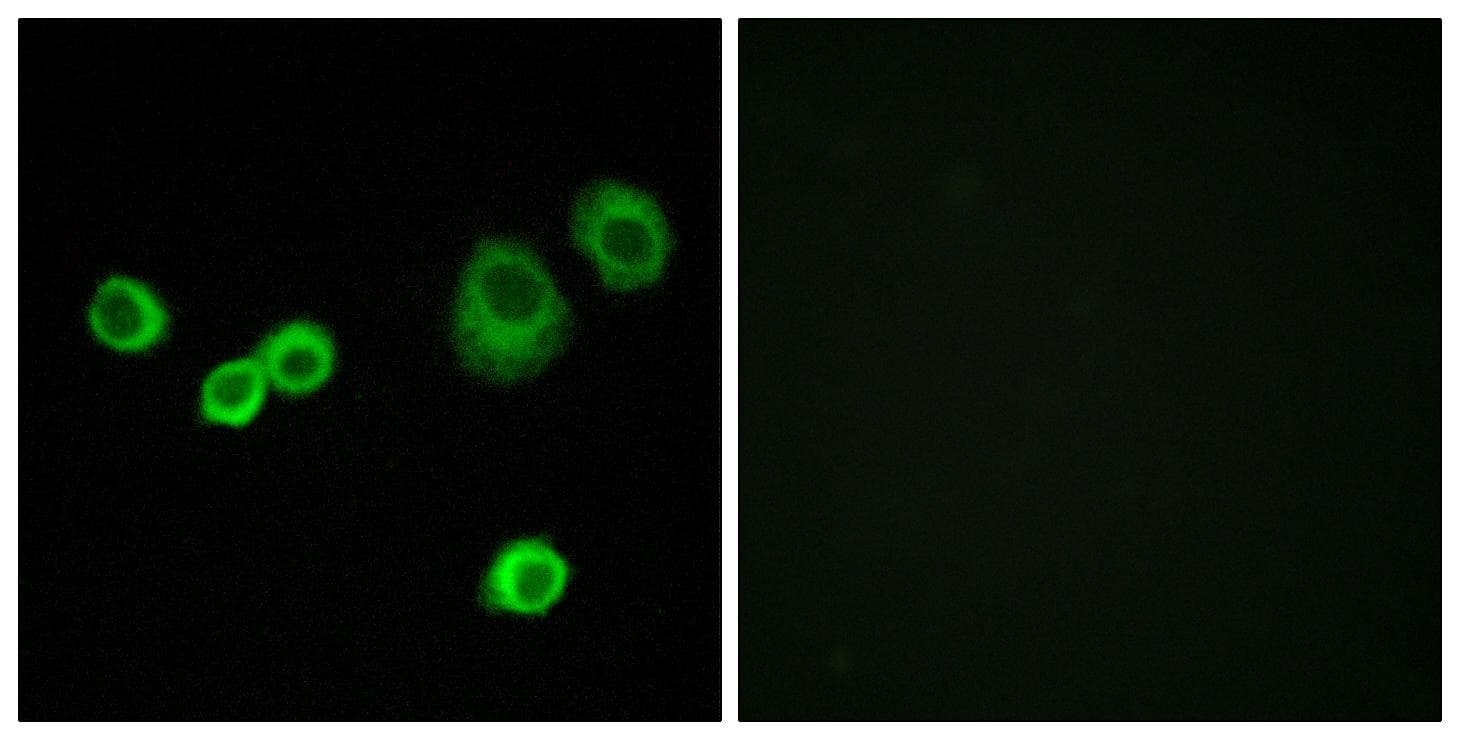HCCS Antibody