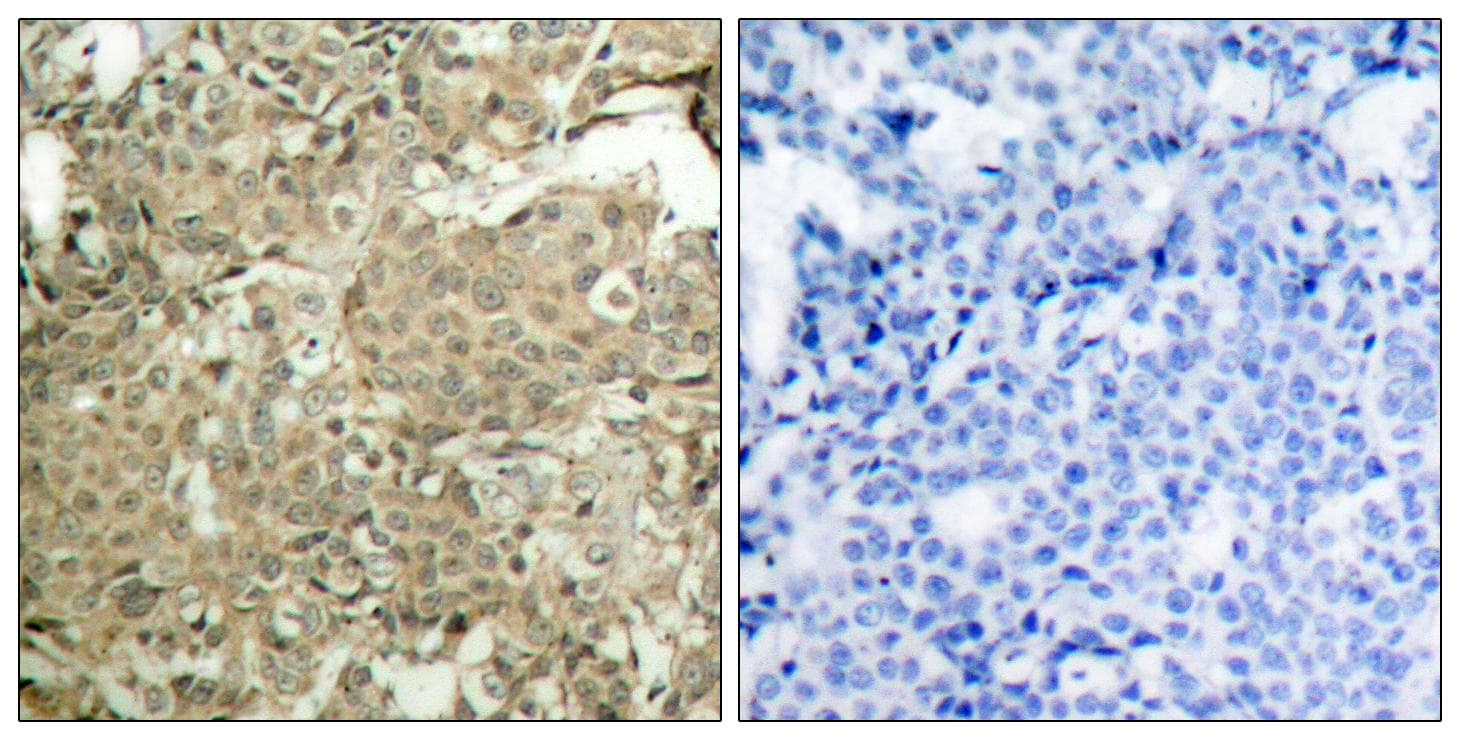 Polyclonal Rabbit anti-Human CFL1 / Cofilin Antibody (phospho-Ser3, IHC, WB)