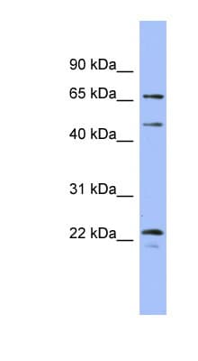 MAPK4 / ERK4 Antibody (aa287-336)