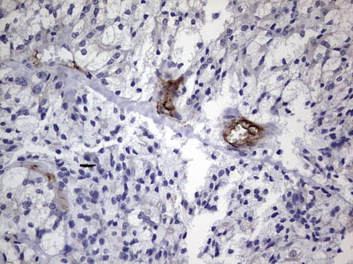 IHC-plus™ CDH4 / R Cadherin Antibody (aa170-428, clone 6H5)