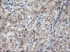 RPN1 / Ribophorin I Antibody (clone OTI3H3)