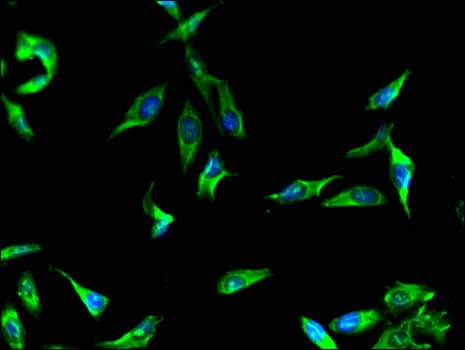 Polyclonal Rabbit anti-Human BBS9 Antibody (IHC, IF)