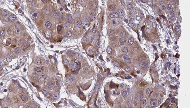 Polyclonal Rabbit anti-Human VAMP2 / VAMP-2 Antibody (aa2-30, IHC, IF, WB)