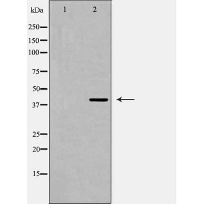Polyclonal Rabbit anti-Human PRLHR / GPR10 Antibody (WB)