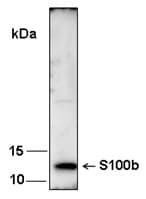 S100B / S100 Beta Antibody (Preservative Free)