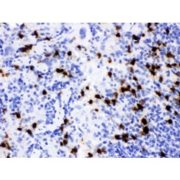 LCN2 / Lipocalin 2 / NGAL Antibody (aa21-200)