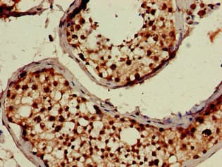 Polyclonal Rabbit anti-Human UBP43 / USP18 Antibody (IHC, IF, WB)