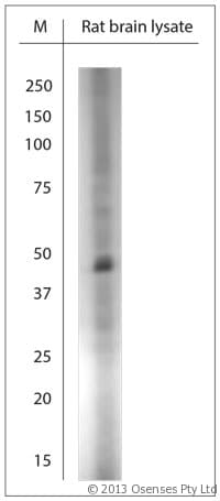 Polyclonal Rabbit anti-Human CLVS1 Antibody (aa300-354, IHC, WB)
