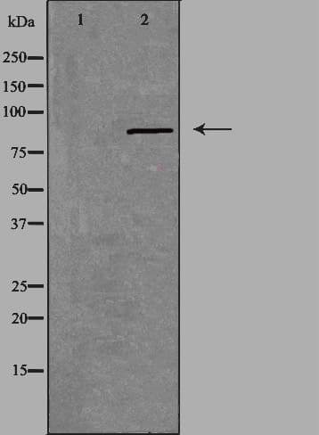 CHPF2 / CSGLCAT Antibody