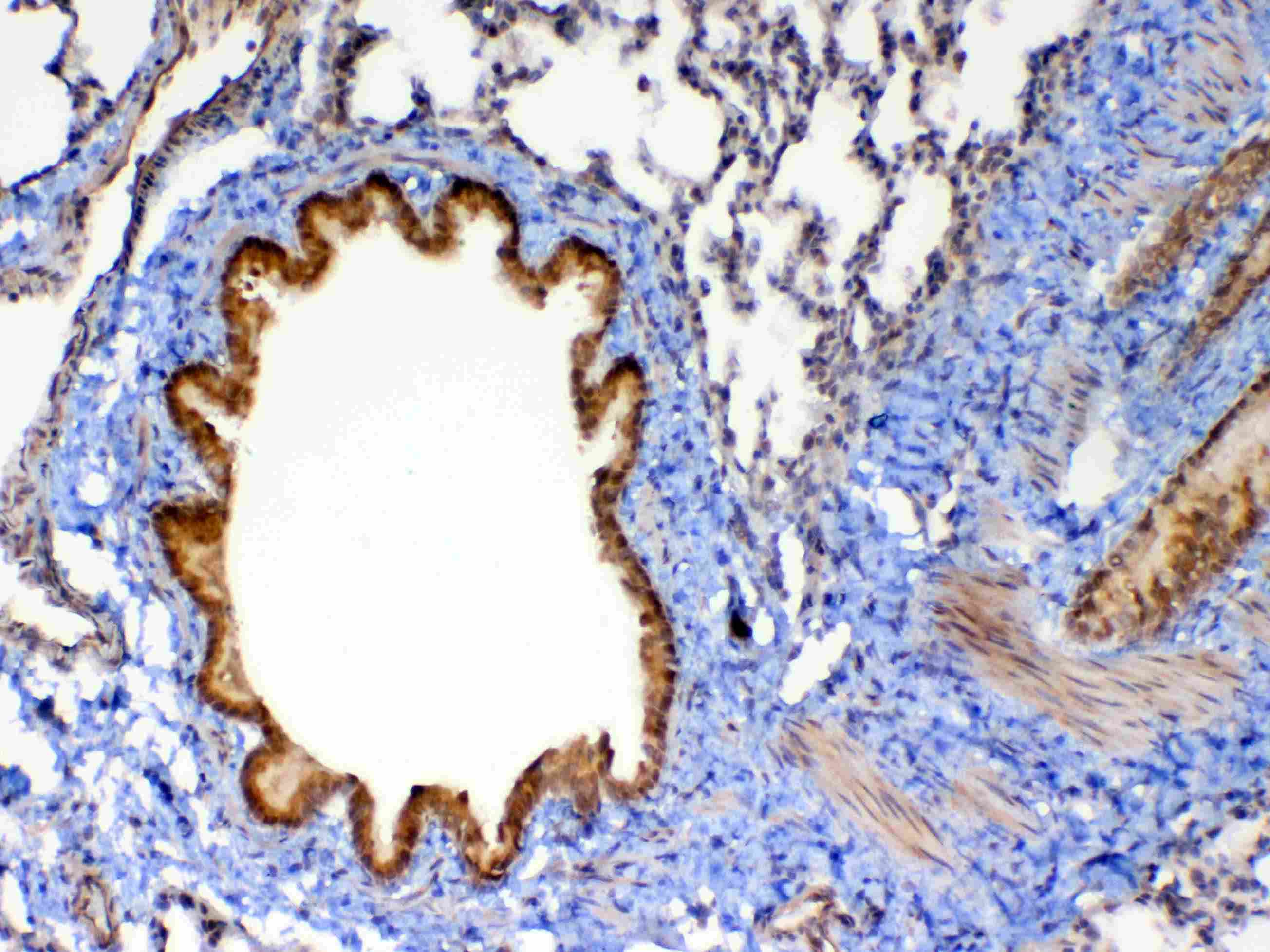 MMP13 Antibody