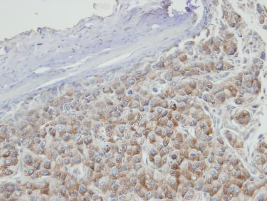 Polyclonal Rabbit anti-Human PRPS2 Antibody (aa1-243, IHC, WB)