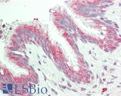 AREL1 / KIAA0317 Antibody (aa179-228)