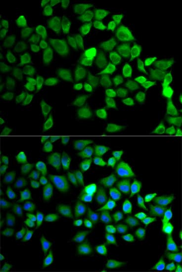 Polyclonal Rabbit anti-Human CUL2 / Cullin 2 Antibody (IHC, IF, WB)