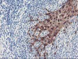 SERPINB2 / PAI-2 Antibody (clone OTI1E3, Carrier-free)