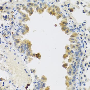 RSPO1 / RSPO Antibody
