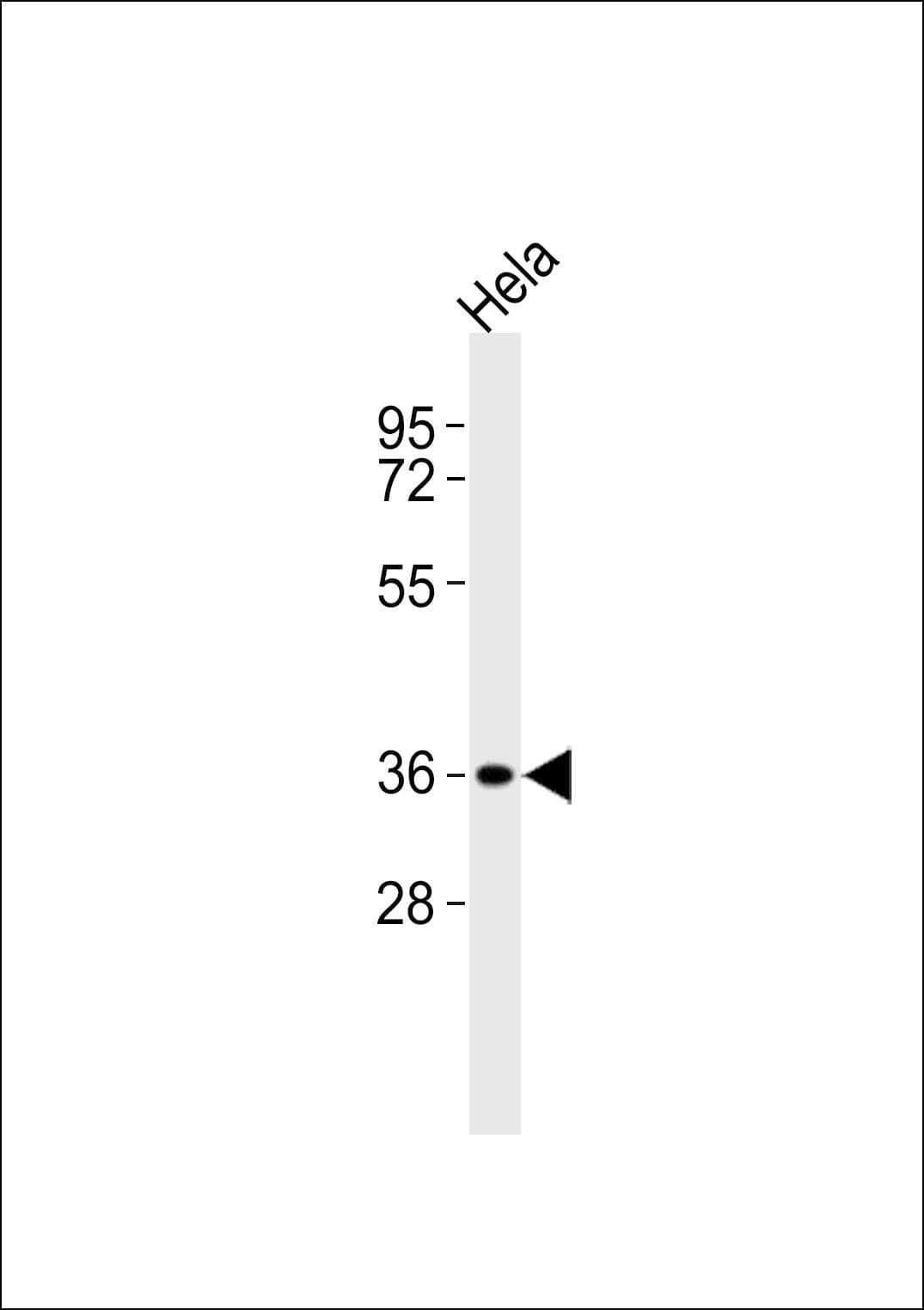 ABI1 / SSH3BP1 Antibody