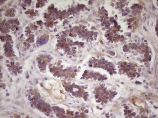 TNFRSF10B / Killer / DR5 Antibody (aa203-411, clone OTI1B9)