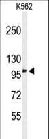 Polyclonal Rabbit anti-Human EFR3A Antibody (aa636-664, WB)