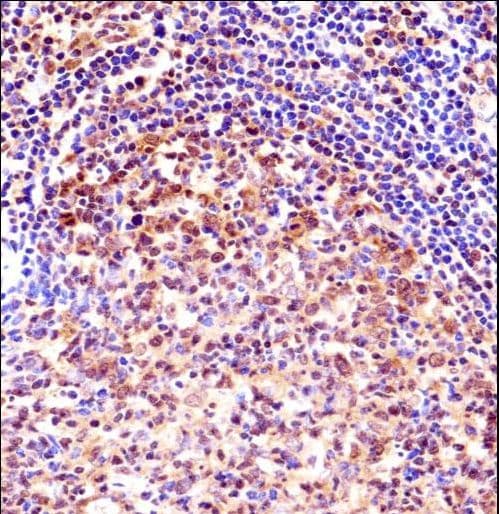 Polyclonal Rabbit anti-Human TCEA1 / TFIIS Antibody (aa98-126, IHC, WB)