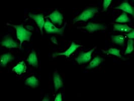 SMS / Spermine Synthase Antibody (clone OTI5F2)