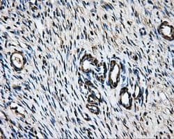 LOX / Lysyl Oxidase Antibody (clone OTI6B7)