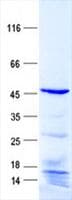 Human TIMP1 Protein (Recombinant GST, N-terminus + His, C-terminus)