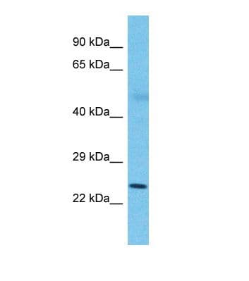 SLC25A26 Antibody (aa20-69)