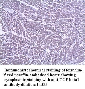 Polyclonal Rabbit anti-Human TGFB1 / TGF Beta 1 Antibody (IHC)