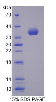 Mouse ALOX12B Protein (Recombinant)