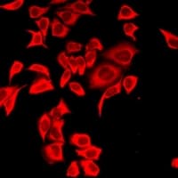 Polyclonal Rabbit anti-Human POC1A / SOFT Antibody (IF, WB)