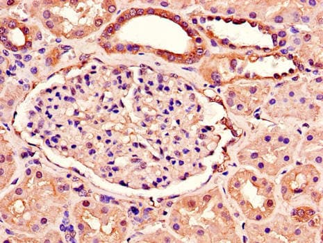 Polyclonal Rabbit anti-Human RAB3IP / RABIN3 Antibody (IHC, IF)