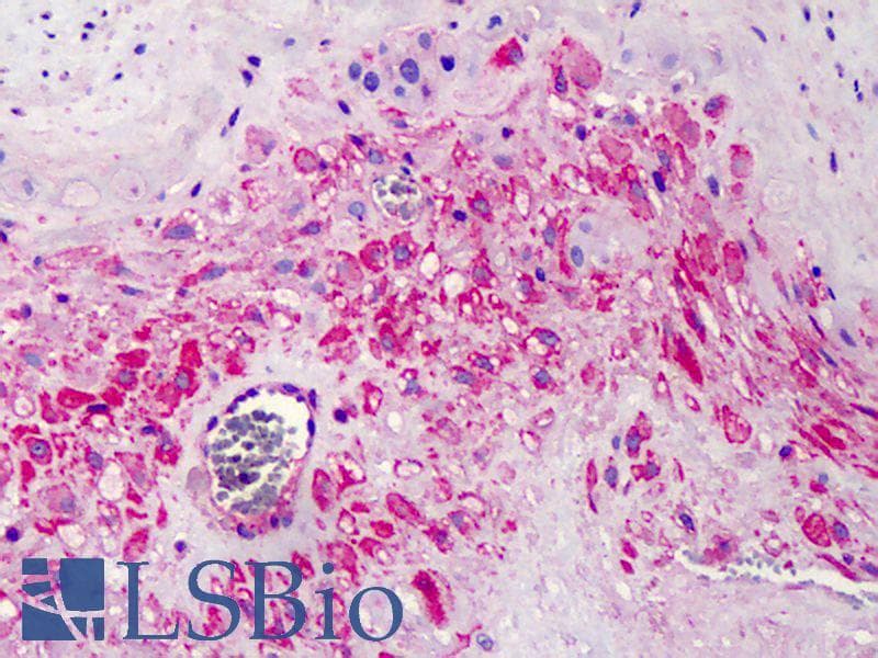 IHC-plus™ COPB2 / Beta-COP Antibody (aa494-511)