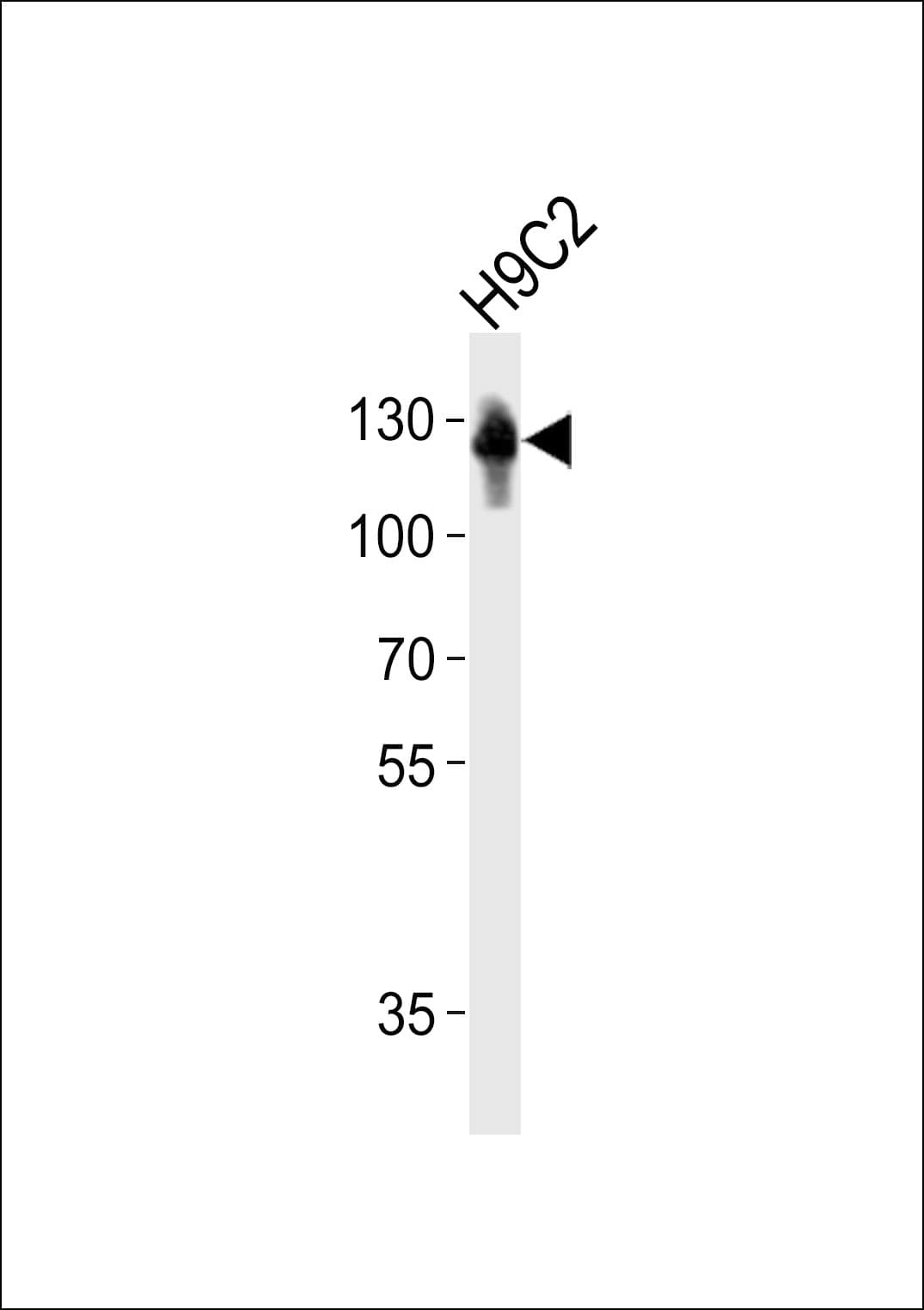 FBLN2 / Fibulin 2 Antibody